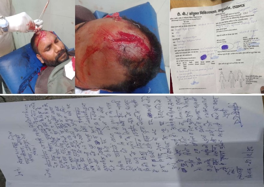 मड़ियाव में युवकों पर जानलेवा हमला, दर्जनभर हमलावरों ने ईंट-पत्थरों से की पिटाई, एक की हालत गंभीर